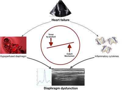 Diaphragm Involvement in Heart Failure: Mere Consequence of Hypoperfusion or Mediated by HF-Related Pro-inflammatory Cytokine Storms?